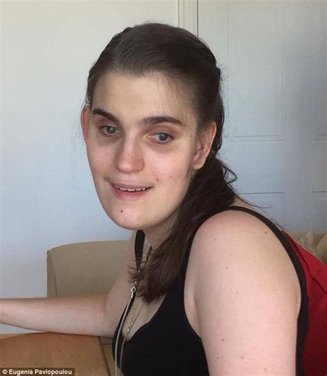 Blind Teen With Cerebral Palsy Alexandra Douros Scores An Atar Of 92