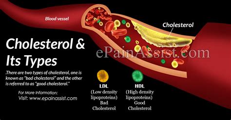 Types Of Cholesterol Its Causes Symptoms Treatment Hypolipidemics Drugs