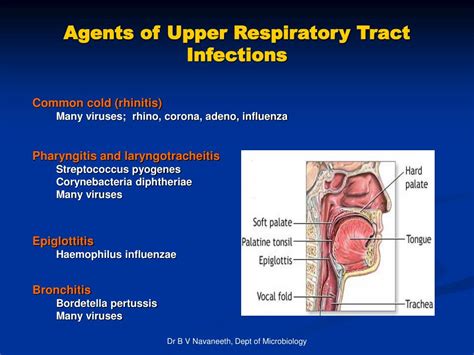 Ppt Respiratory Tract Infections Rti Powerpoint Presentation Free