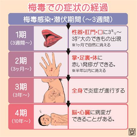 梅毒とは？原因・症状・検査・治療など | 新宿駅前クリニック ...