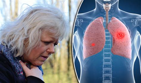 Lung Cancer Symptoms Coughing And Breathlessness Major Signs Health