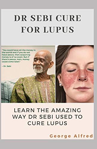 Dr Sebi Cure For Lupus Lean The Amazing Way Dr Sebi Used To Cure Lupus