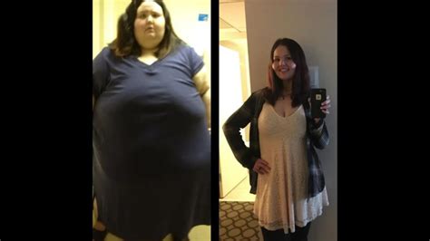 Weight Loss Year Old Woman Sheds Kg In A Massive Weight Loss