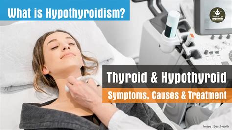 Hypothyroidism Symptoms Causes And Treatment Hypothyroid Thyroid