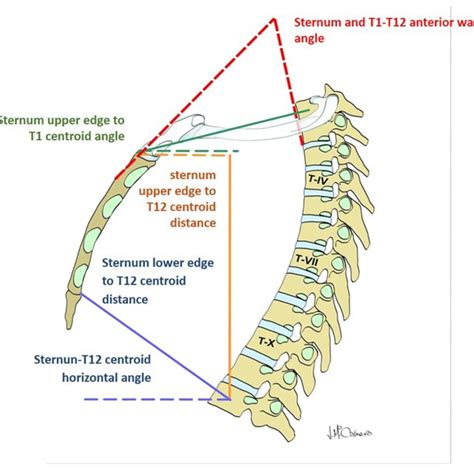 Kyphotic Angles And Range Of Motion Rom Of Thoracic Spine Segments
