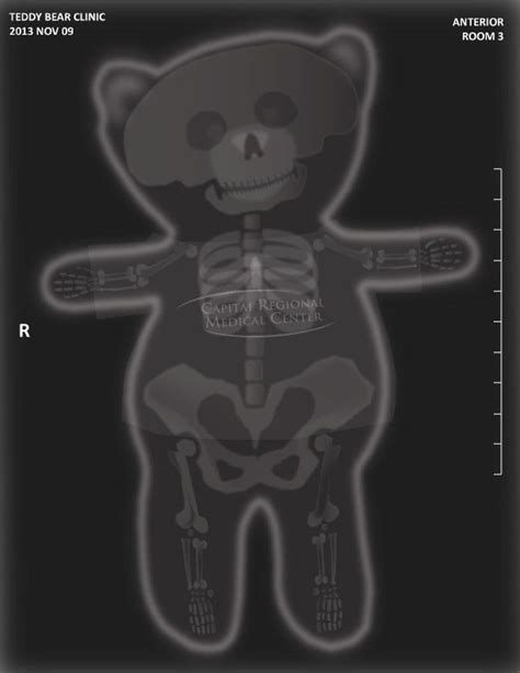 Animal X Rays Printable Matching Activity Artofit