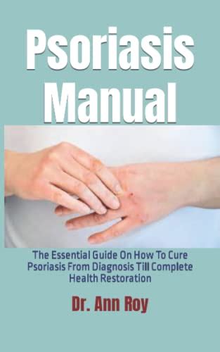 Psoriasis Manual The Essential Guide On How To Cure Psoriasis From
