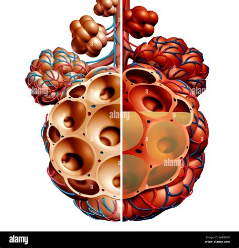 Pneumonia And Pulmonary Alveoli With Fluid Diagram Or Alveolus