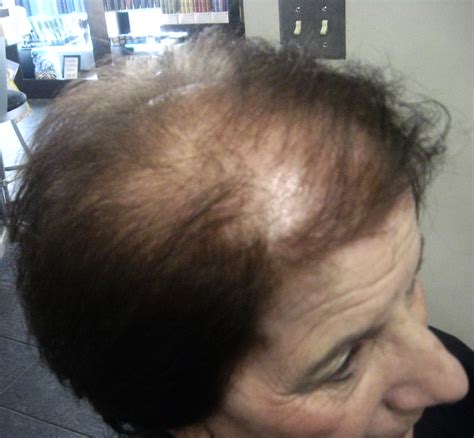 In a deep way, it could make strong color. Over 30 Million Women Suffer From Thinning Hair. Now New ...