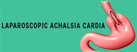 Laparoscopic Achalasia Cardia Dr Gaurav Mishra General