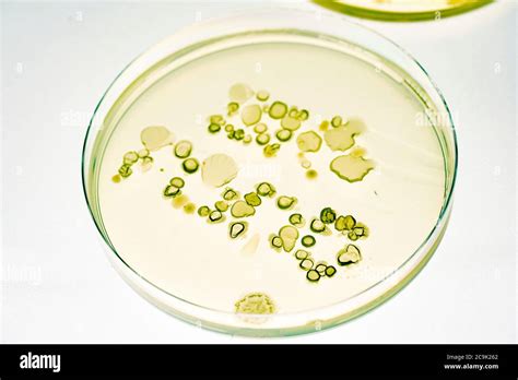 Bacterial Colonies On Agar Plate Stock Photo Alamy
