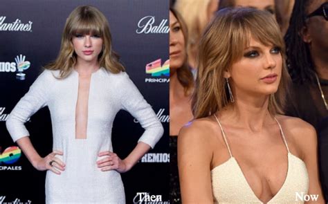 Taylor Swift Plastic Surgery Before And After Photos Boob Job