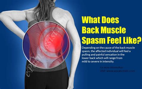 Can Sciatica Cause Muscle Spasms Brandon Orthopedics