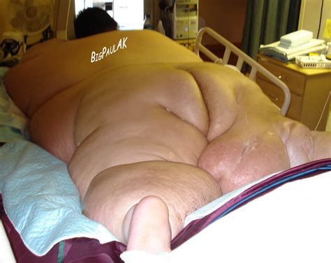 Obese Immobile Ssbbw Blob Sexy Photos Pheonix Money