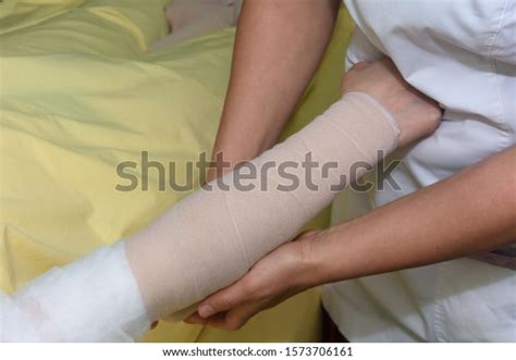 Lymphedema Management Wrapping Lymphedema Hand Arm Stock Photo