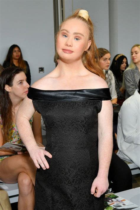 The Worlds Most Famous Model With Down Syndrome Plans To Be A Victoria