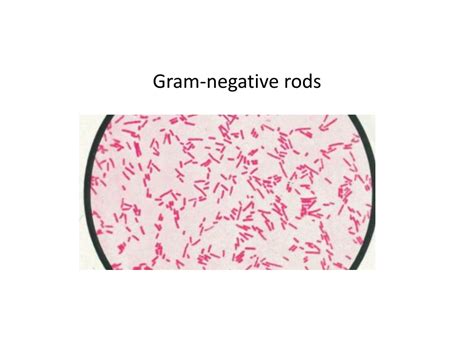 Ppt Gram Negative Rods Powerpoint Presentation Free Download Id868349
