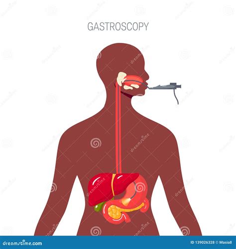 Endoscopy Diagnostic Concept In Flat Style Stock Illustration