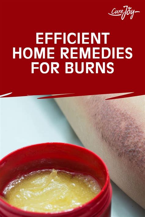 Efficient Home Remedies For Burns With Images Home Remedies For