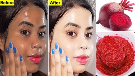 I Apply Beetroot Face Pack Daily To Get Instant Bright And Glowing Skin