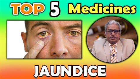 Top 5 Homeopathy Medicines For Jaundice Dr Ps Tiwari Youtube