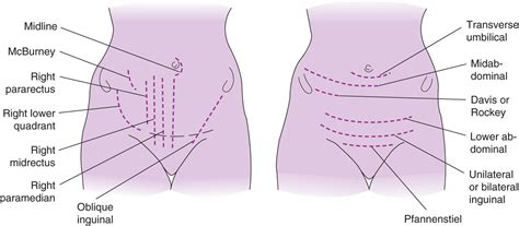 Find the perfect anatomy female abdomen stock photo. Anatomy of the Female Reproductive System - Current Diagnosis & Treatment Obstetrics ...