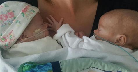 Miracle Of Unborn Twins Whose Lives Were Saved By Laser Beam In The Womb Mirror Online