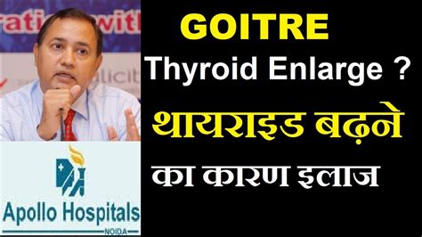 Thyroid Enlargement Nodule Multinodular Goitre Cause Treatment Delhi Dr