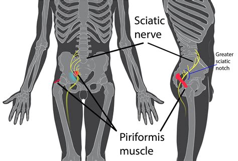 Sciatica Pain Management With Acupuncture And More Endpoint Wellness