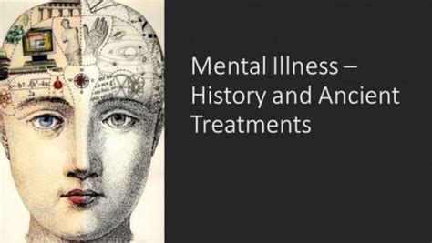 Cruel And Ineffective Treatments For Mental Illness Prior To The 1900s By Jc Scull