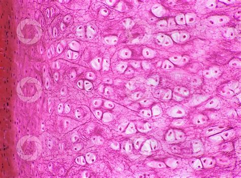 Histology Gallery Hyaline Cartilage Histology Slides Nasal Septum