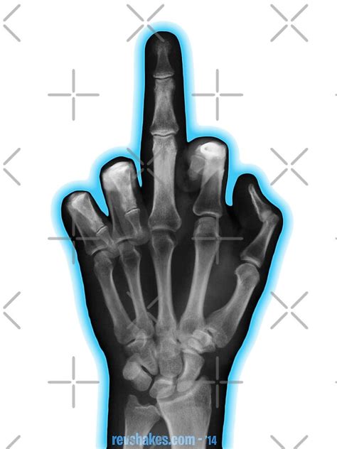Middle Finger X Ray By Revshakes Redbubble