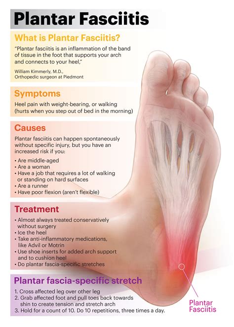Heel Pain Differential Diagnosis