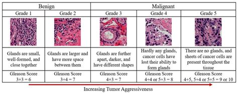 Cancer Histology Types