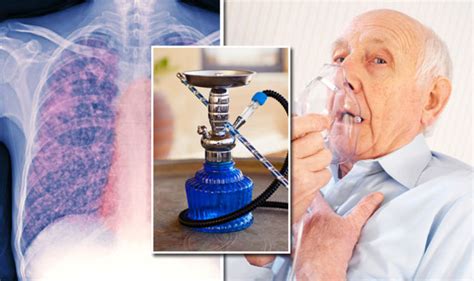 Heart Disease And Copd Risk Smoking Shisha Tobacco As Harmful As Ten
