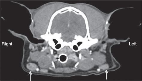 Figure 9 From Bilateral Removal Of The Mandibular And Medial