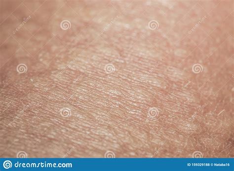 Background Of The Unhealthy Irritated Human Skin Is Covered With