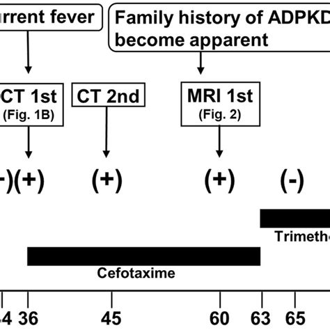 Timeline Of The Case Adpkd Autosomal Dominant Polycystic Kidney