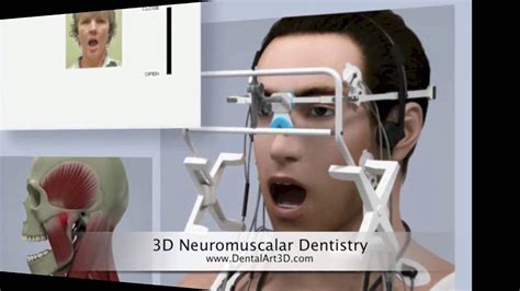 Dentalart3d 3d Neuromuscular Dentistry Youtube