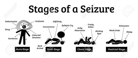 Stages And Phases Of A Seizure Illustrations Depicts The Phases When A Person Get A Seizure