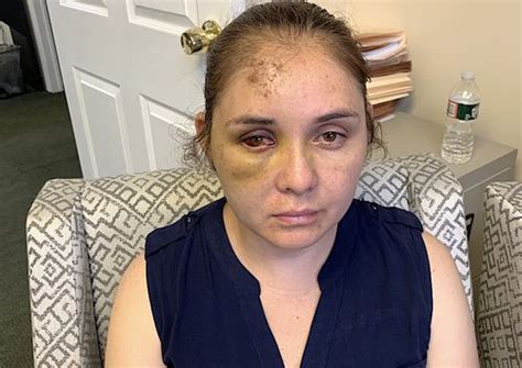 Nj Mom Beaten Unconscious By School Bully Who Threatened Her Son In