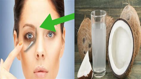 How To Apply Coconut Oil Under The Eye Area Youtube