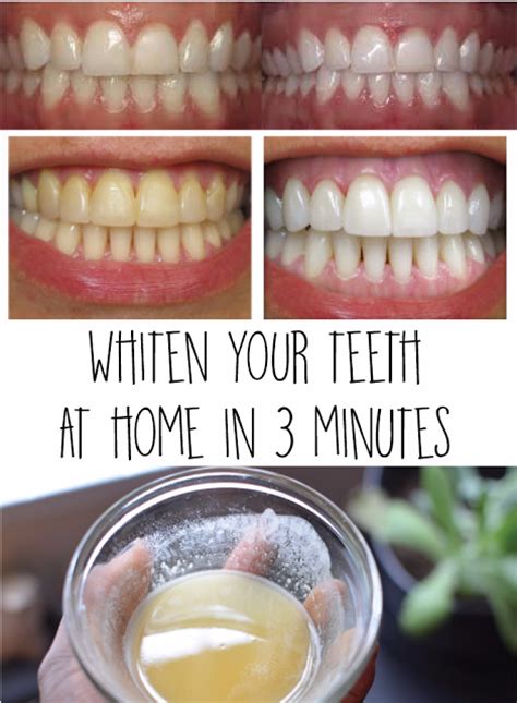 Hold Life Whiten Your Teeth At Home In 3 Minutes