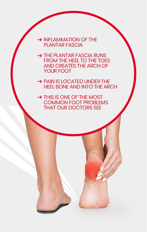 Heel Pain Plantar Fasciitis Absolute Footcare