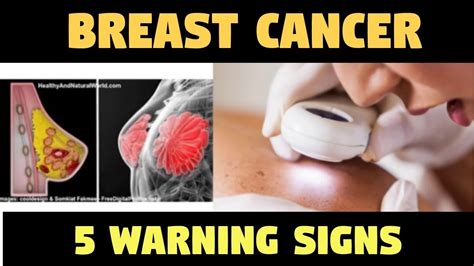 ATTENTION 5 Warning Signs Of BREAST CANCER That Many Women Ignore