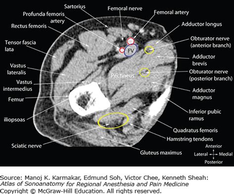 Upper Thigh Muscles Ct Anatomy Mri Of The Thigh Detailed Anatomy