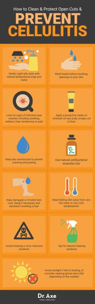 Cellulitis Treatment Natural Remedies And Prevention Tips Dr Axe