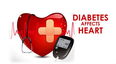 Diabetes increases your risk of heart disease and stroke by accelerating the development of clogged and hardened arteries. Get More Aware Of Diabetes-Heart Disease Link | Diabetic ...