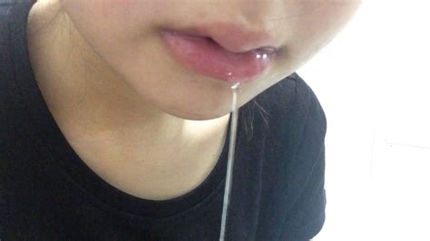 韓国で両顎手術後・・・唾液が止まらない Youtube