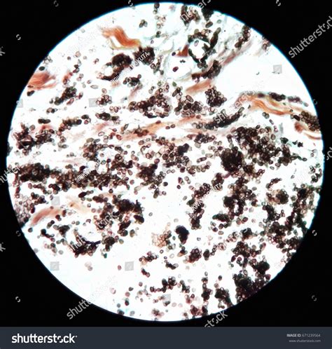 Smear Tissue Biopsy Giemsa Stained Under Stock Photo 671239564